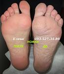     
: IMG_1872 педикюр до и по.JPG
: 48
:	71.3 
ID:	10010725