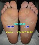     
: IMG_1955 педикюр до и по.JPG
: 21
:	71.1 
ID:	10081025