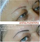     
: 2_татуаж_6D_ одесса.jpg
: 69
:	172.0 
ID:	10241709