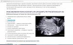     
: Снимок.JPG
: 73
:	128.9 
ID:	10292344