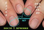     
: IMG_2340 после 1 лечния.JPG
: 33
:	48.2 
ID:	10353478
