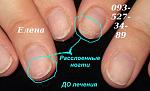     
: IMG_2338 до лечения.JPG
: 20
:	49.3 
ID:	10353479