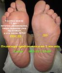     
: IMG_2287 пед. прибл 2 мес &#10.JPG
: 13
:	83.6 
ID:	10353482