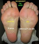     
: IMG_2430 педикюр (76 дн) до &#.JPG
: 3
:	75.8 
ID:	10398313