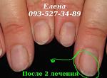     
: IMG_2411 2 лечение.JPG
: 3
:	40.8 
ID:	10398324