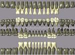     
: Primary_dentition.jpg
: 32
:	114.2 
ID:	10626426