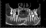     
: 2015-12-16-2.jpg
: 73
:	174.3 
ID:	10698962