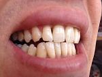     
: IMG_1611.jpg
: 22
:	76.9 
ID:	10785452