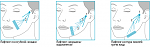     
: proc_radiesse2.png
: 253
:	41.2 
ID:	11132960