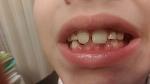     
: IMAG1802.jpg
: 19
:	48.4 
ID:	11195572