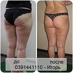     
: До_после-Света_П&#.jpg
: 13
:	89.5 
ID:	11457652