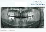     
: Scan.jpg
: 54
:	112.6 
ID:	11849451