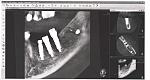     
: 11111 002.jpg
: 39
:	121.0 
ID:	12260996