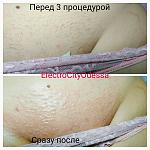     
: TTLnVQRMWdE.jpg
: 26
:	75.7 
ID:	12547909