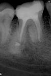     
: 6_46_21_01_2011.JPG
: 18
:	25.7 
ID:	12549156