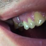     
: IMG_E2269.jpg
: 21
:	52.7 
ID:	12870040