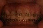     
: tooth_straight.jpg
: 16
:	38.0 
ID:	12900760