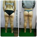     
: .jpg
: 20
:	170.8 
ID:	12995079