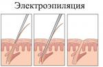     
: big_el_n.jpg
: 15
:	26.7 
ID:	13050978