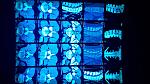     
: 20190314_185239.jpg
: 84
:	163.7 
ID:	13062377