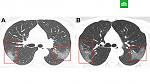     
: virus52_io.jpg
: 39
:	121.9 
ID:	13319753