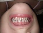     
: IMG_20201113_140631.jpg
: 107
:	52.7 
ID:	13425135