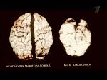     
: img-76824-02e74f10e0.jpg
: 13
:	41.6 
ID:	2397218