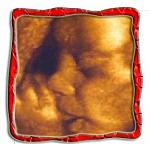     
: 30nedelberemennosti2300x288.jpg
: 73
:	20.6 
ID:	3193561