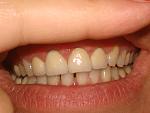     
: DSC02353.jpg
: 13
:	79.9 
ID:	4560834