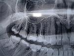     
: P7233640.jpg
: 14
:	100.7 
ID:	4578576