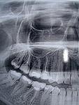     
: P7233646.jpg
: 14
:	70.0 
ID:	4578577