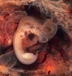     
: 562px-Tubal_Pregnancy_with_embryo.jpg
: 7
:	63.0 
ID:	5147557