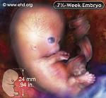     
: embryoGallery.jpg
: 6
:	20.0 
ID:	5147598