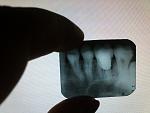    
: 2013-09-18 21.38.44.jpg
: 34
:	168.2 
ID:	6872623