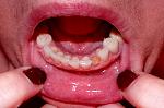     
: 20131101_222225.jpg
: 40
:	92.0 
ID:	7131623