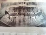     
: IMG_20140604_165018.jpg
: 46
:	118.2 
ID:	8252181