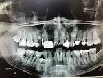     
: IMG_20140606_161856.jpg
: 97
:	160.1 
ID:	8274619