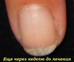     
: IMG_0177 чз нед до   3a.jpg
: 8
:	44.1 
ID:	8578723