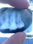    
: IMG_20141007_112329.jpg
: 24
:	48.6 
ID:	8819481