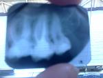     
: IMG_20141007_112341.jpg
: 23
:	72.3 
ID:	8819482