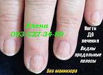     
: IMG_1377 до лечения Д.jpg
: 12
:	40.9 
ID:	9868236