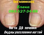     
: IMG_1378 до лечения Д.jpg
: 12
:	25.1 
ID:	9868238
