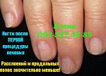     
: IMG_1379 после лечения1 .jpg
: 13
:	44.0 
ID:	9868245