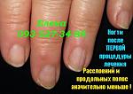     
: IMG_1381 после лечения1 .jpg
: 12
:	44.0 
ID:	9868246