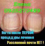     
: IMG_1384 после лечения1 .jpg
: 12
:	27.0 
ID:	9868247