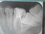     
: 2015403141102.jpg
: 60
:	121.7 
ID:	9898237