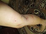     
: IMG_1541.jpg
: 210
:	123.8 
ID:	9927285