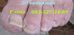     
: IMG_1738 педикюр до.JPG
: 13
:	28.1 
ID:	9939237